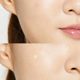 COSRX Acne Pimple Master Patch (24 PCS)
